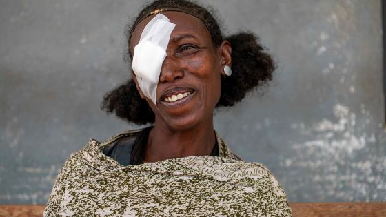 image:Image Kromě operací šedého zákalu Světlo pro svět zařídilo 220 tisíc operací očních víček v případě trachomu. Absolvovala ji i paní Guesh z Etiopie.